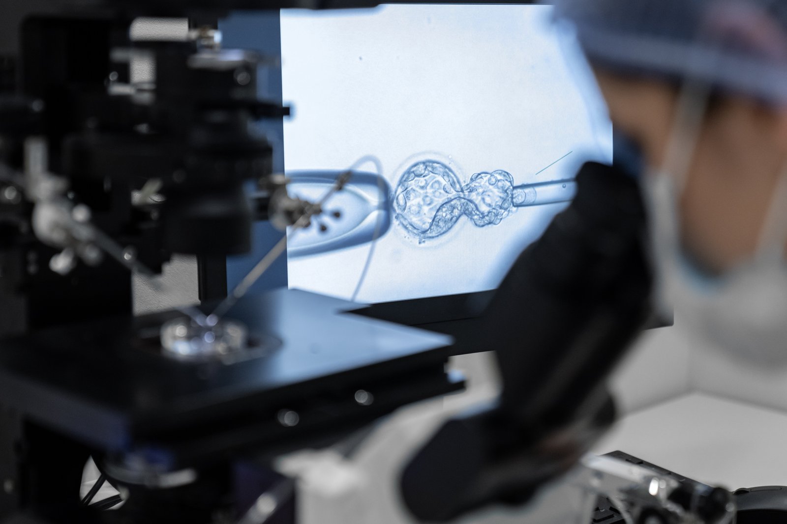 Un procedimiento de inseminación artificial se lleva a cabo en un laboratorio de fecundación in vitro. (Shutterstock)