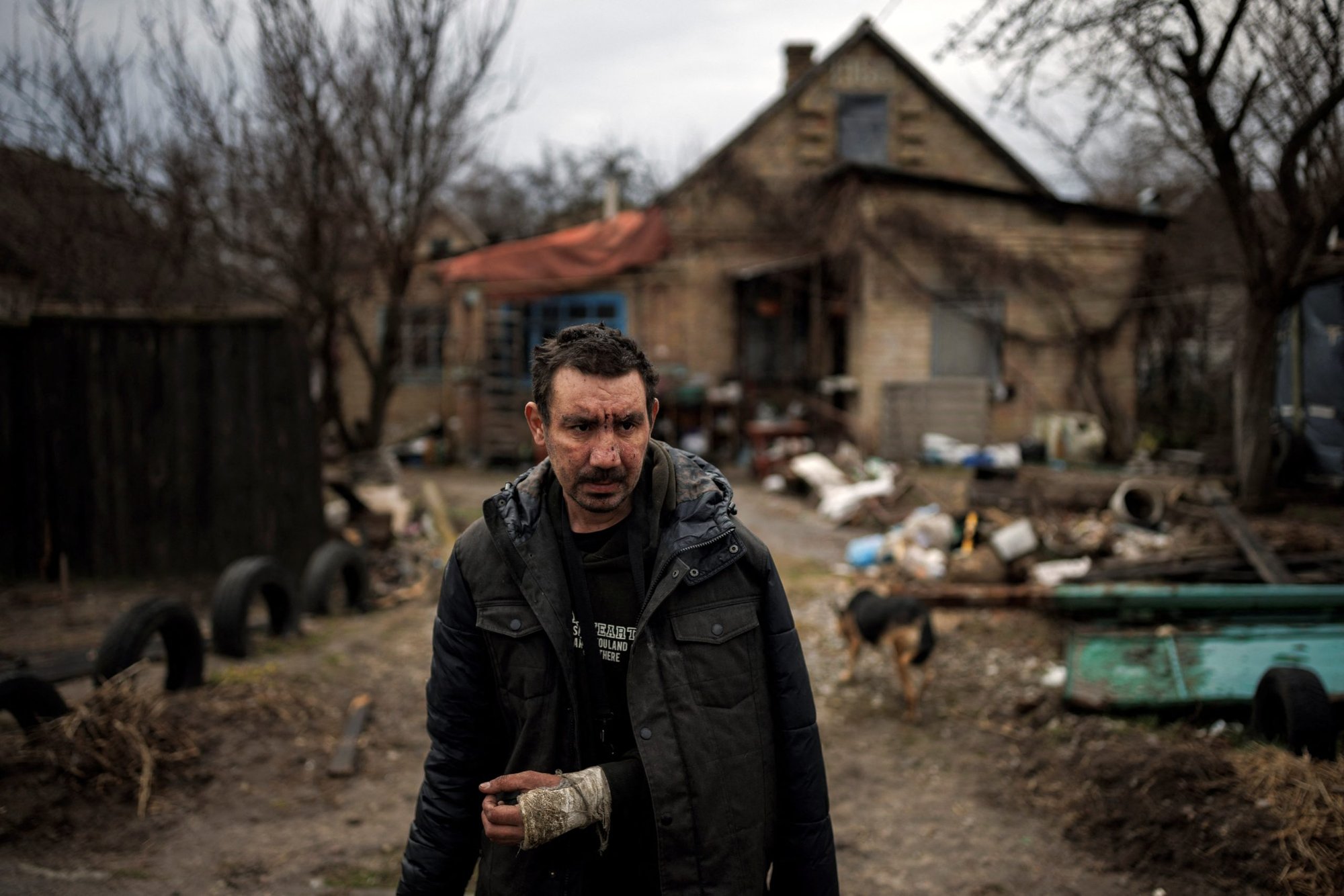Un hombre que dice que los soldados rusos le rompieron el brazo se encuentra fuera de su casa en Bucha, Ucrania, el 6 de abril de 2022. (Foto CNS /Alkis Konstantinidis, Reuters)