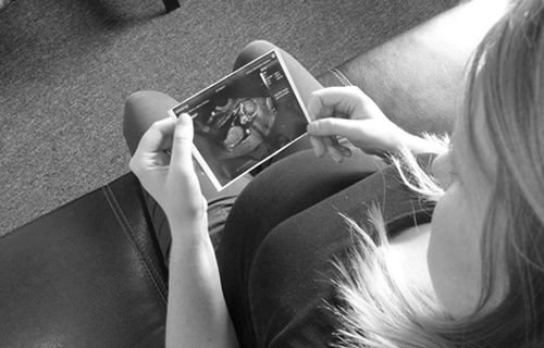 A woman looks at a sonogram image of her unborn baby. Credit: Katy Senour/CNA.