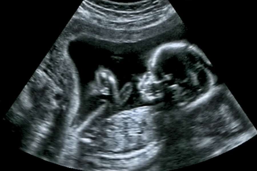 Ultrasound image (shutterstock.com)
