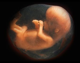 UK fetal incineration scandal prompts calls to respect life