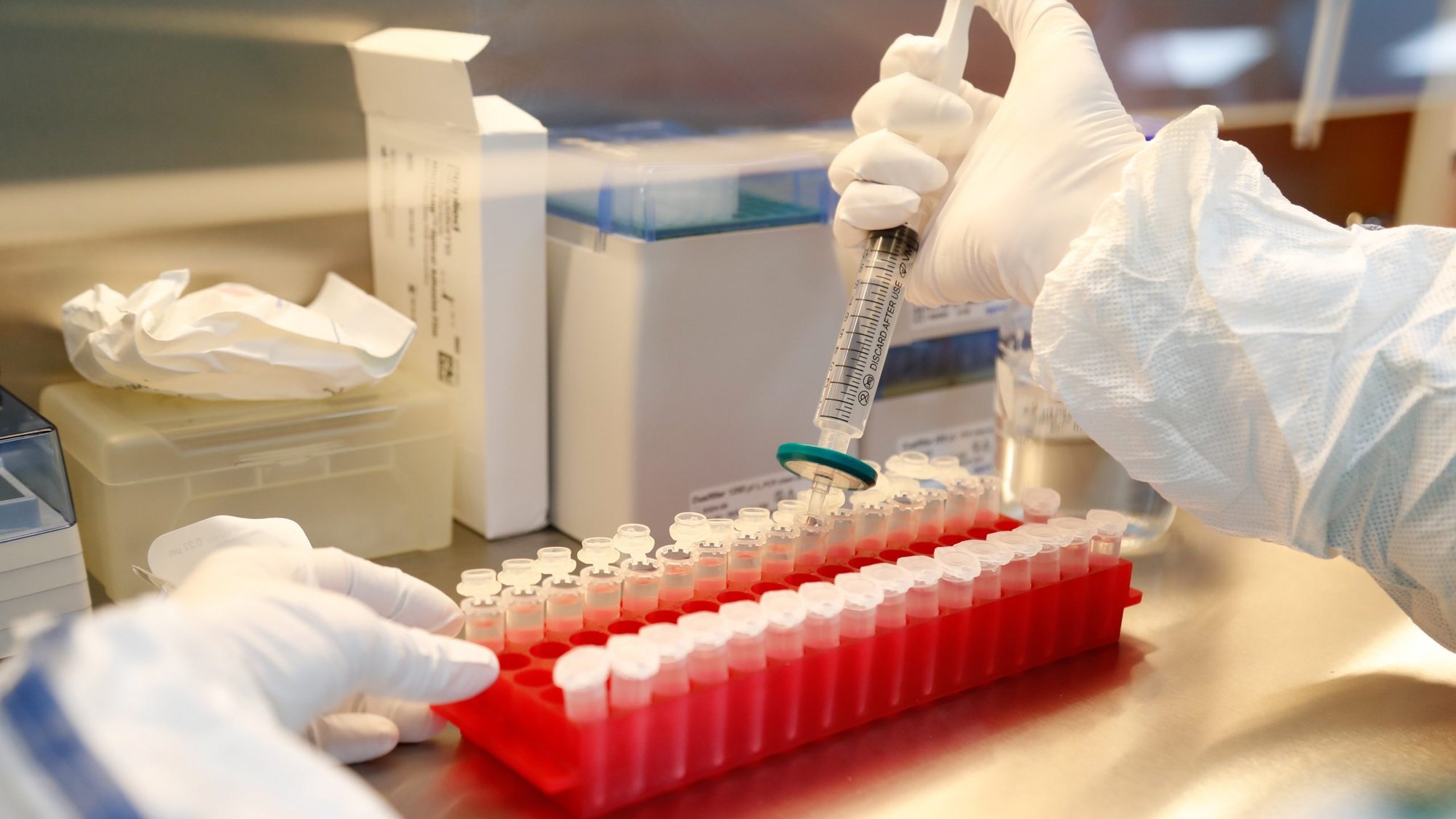 A scientist filters out samples during the research and development of a vaccine against COVID-19 June 11, 2020, at a laboratory in St. Petersburg, Russia. Spanish Cardinal Antonio Canizares Llovera of Valencia made headlines June 5, 2020, when he described as a "work of the devil" attempts to find a COVID-19 vaccine using cell lines created from fetuses aborted voluntarily decades ago. (CNS photo/Anton Vaganov, Reuters)