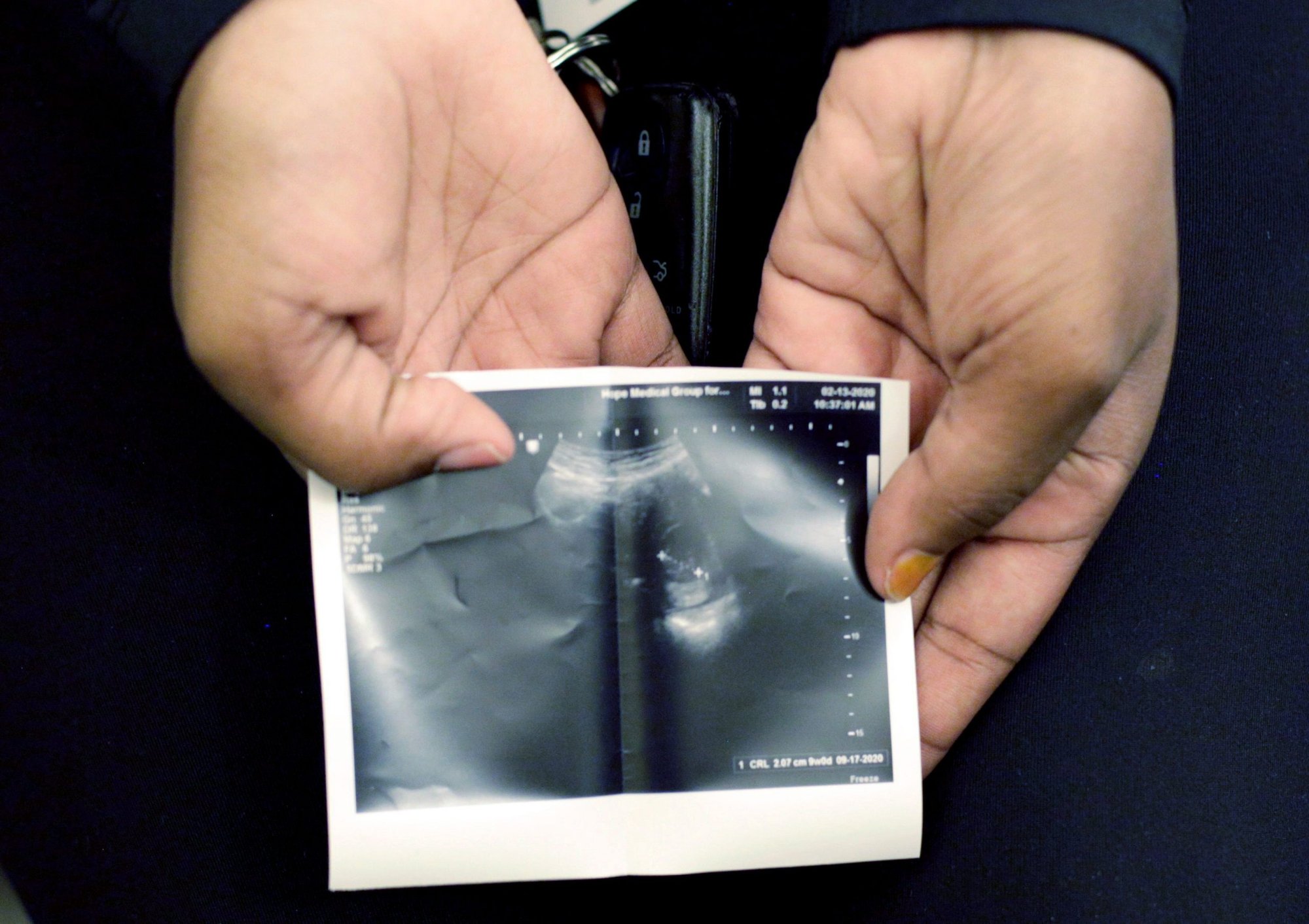 A pregnant Texas woman holds an image from a sonogram she received at the Hope Medical Group for Women in Shreveport, La., Feb. 13, 2020. Texas Gov. Greg Abbott signed into law a "heartbeat" measure May 19, 2021, that would prohibit abortions as early as six weeks. (CNS photo/Lila Engelbrecht, Reuters)