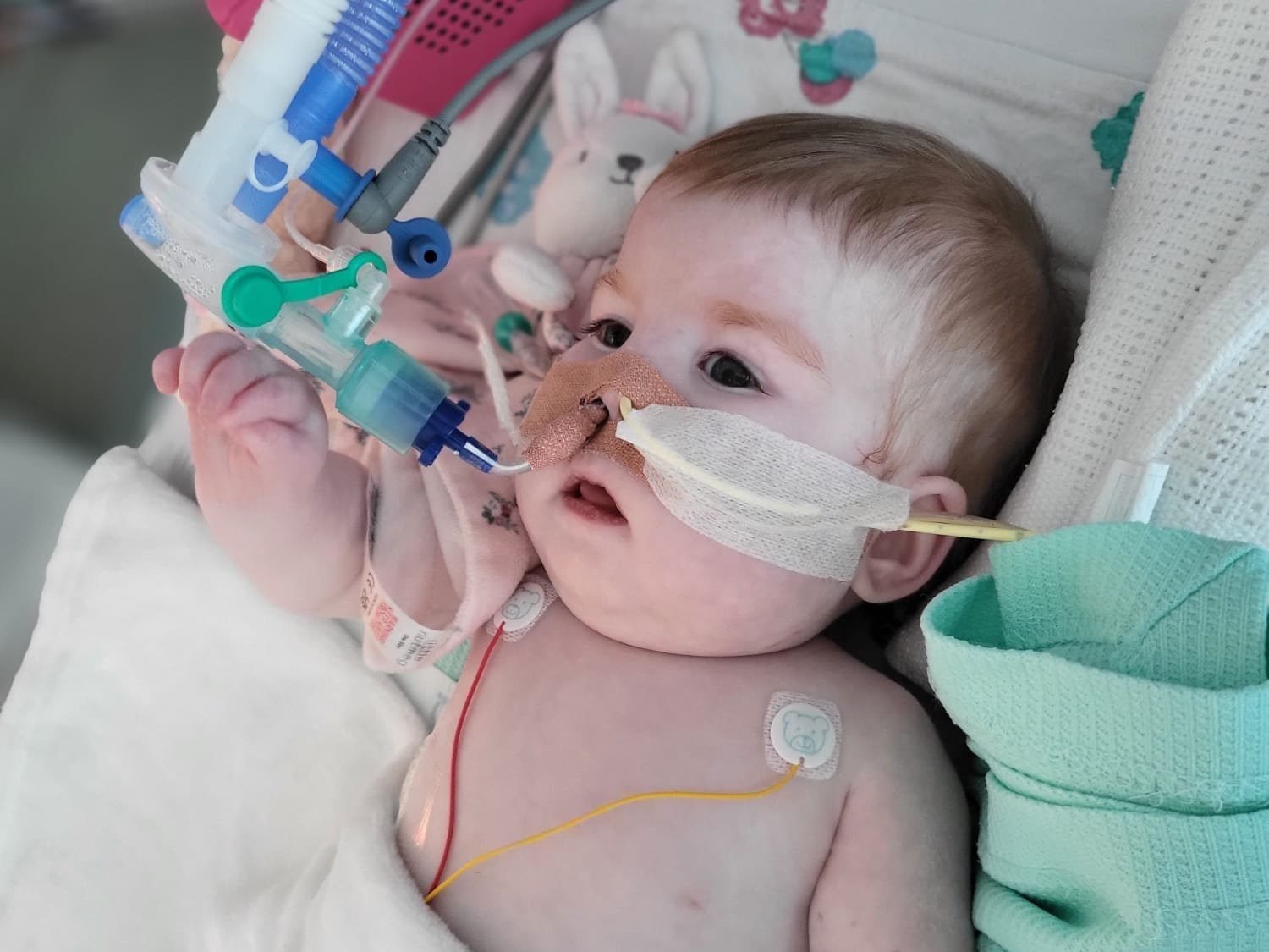 Indi Gregory, an 8-month-old child suffering from a degenerative disease, pictured in an undated photo, was at the center of a legal battle in the U.K. to keep her on life support. She died on Nov. 13, 2023. (OSV News/courtesy Indi Gregory family via Christian Concern)