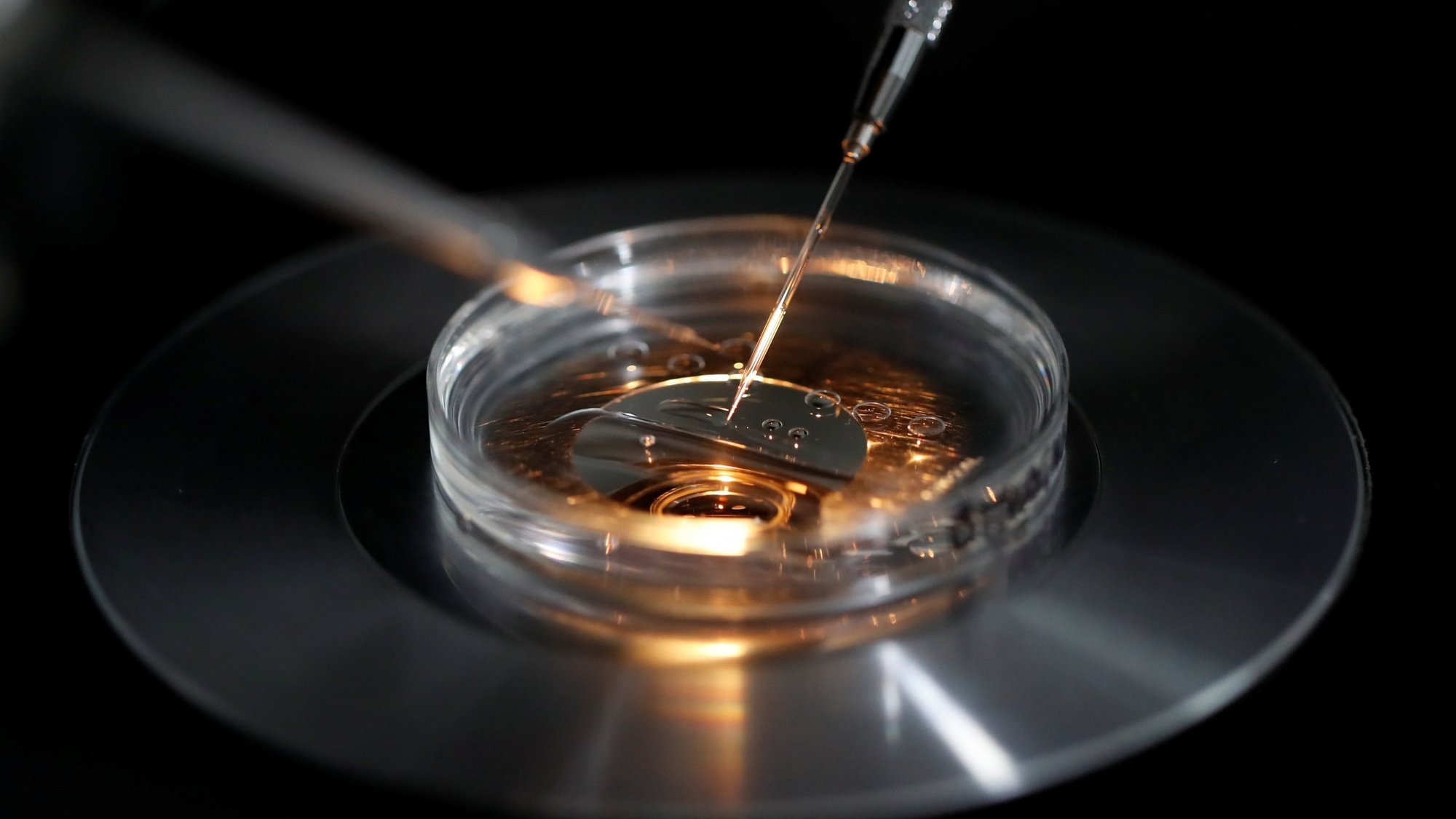 A medical lab technologist operates an embryo vitrification during an intra cytoplasmic sperm injection process (ICSI) at a laboratory Sept. 13, 2019. (OSV News photo/Christian Hartmann, Reuters)