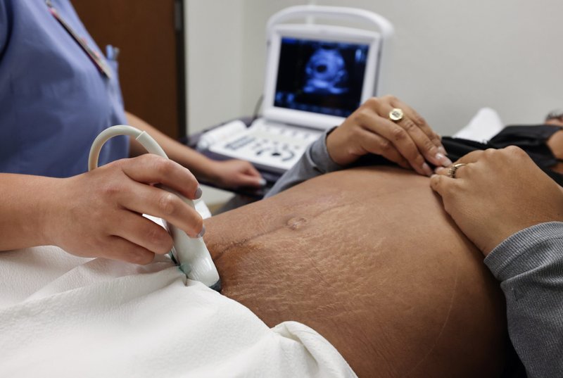 En esta foto ilustrativa se realiza una ecografía. Se calcula que unas 400.000 personas en EE.UU. tienen síndrome de Down y que su esperanza de vida está aumentando gracias a los avances médicos, pero forman parte de una población cada vez menor de personas con esta afección debido al aborto basado en un diagnóstico prenatal, según los ponentes de un panel celebrado el 19 de marzo de 2024 y patrocinado por el Instituto de Ecología Humana de la Universidad Católica de América en Washington. (Foto OSV News/Evelyn Hockstein, Reuters)
