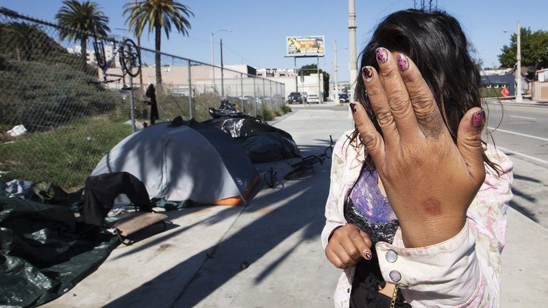 A homeless woman shields her face. On any given night in Los Angeles County, there are nearly 58,000 persons who are homeless. (Victor Alemán)