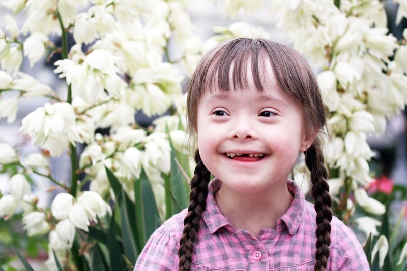 Young girl with Down Syndrome. (shutterstock)