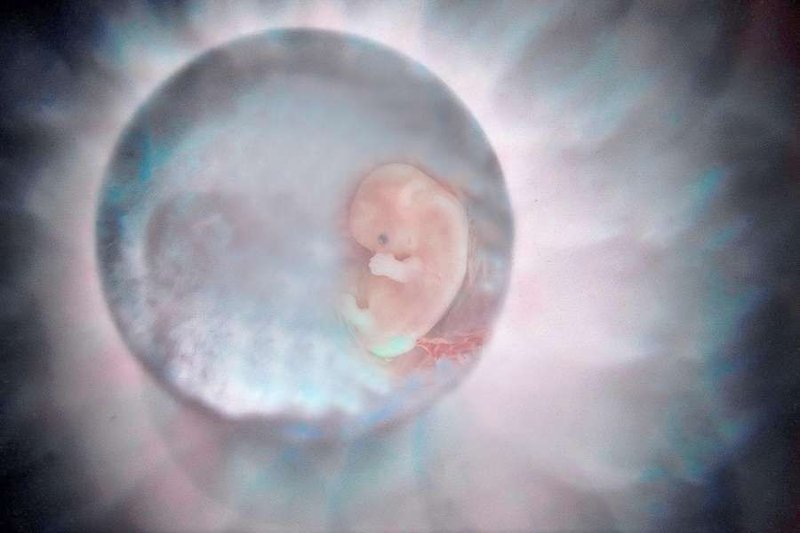 Human Embryo