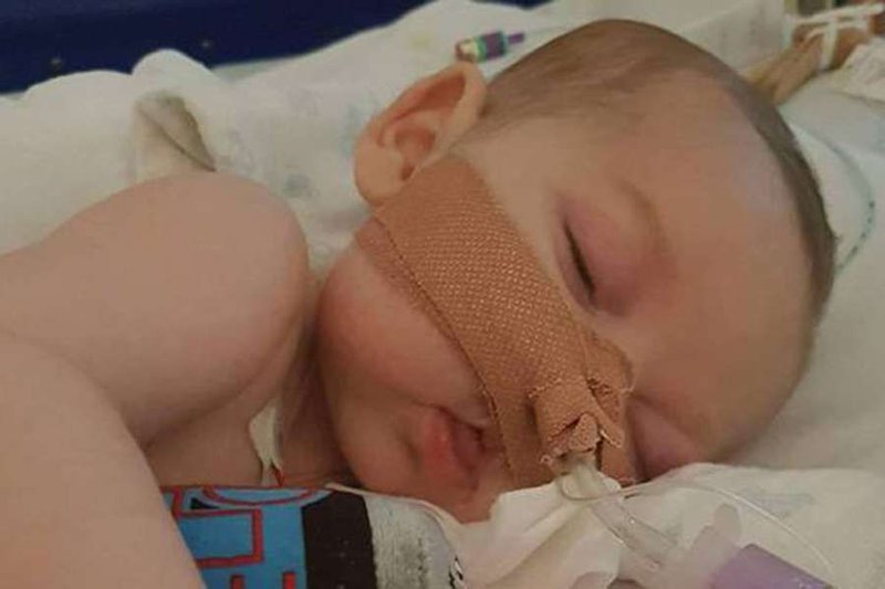 Charlie Gard. Photo: Facebook