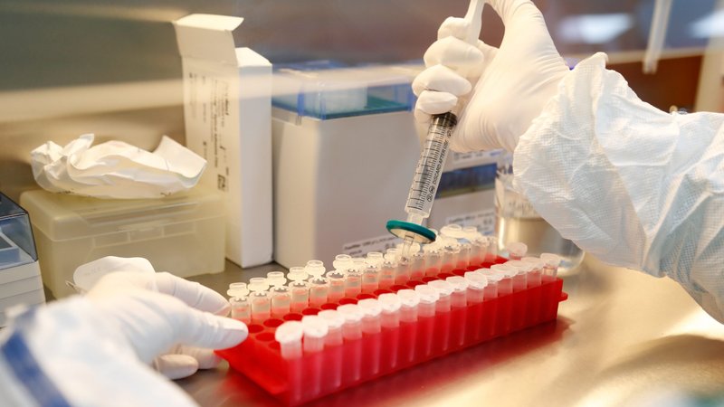 A scientist filters out samples during the research and development of a vaccine against COVID-19 June 11, 2020, at a laboratory in St. Petersburg, Russia. Spanish Cardinal Antonio Canizares Llovera of Valencia made headlines June 5, 2020, when he described as a "work of the devil" attempts to find a COVID-19 vaccine using cell lines created from fetuses aborted voluntarily decades ago. (CNS photo/Anton Vaganov, Reuters)