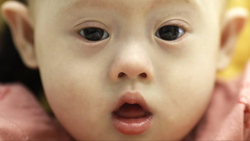 A baby born with Down Syndrome is pictured in a file photo. The chairman of the English and Welsh bishops' Department for Social Justice expressed distress that people with learning disabilities were given Do Not Attempt Cardiopulmonary Resuscitation (DNACPR) orders during the second wave of the COVID-19 pandemic. (CNS photo/Damir Sagolj, Reuters)