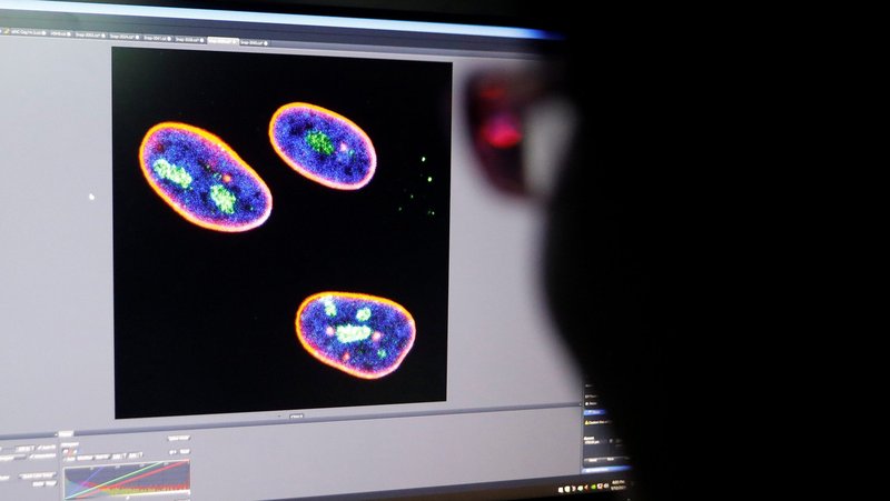 A researcher observes the nucleus of human stem cells in this illustration photo. (CNS photo/Tingshu Wang, Reuters)