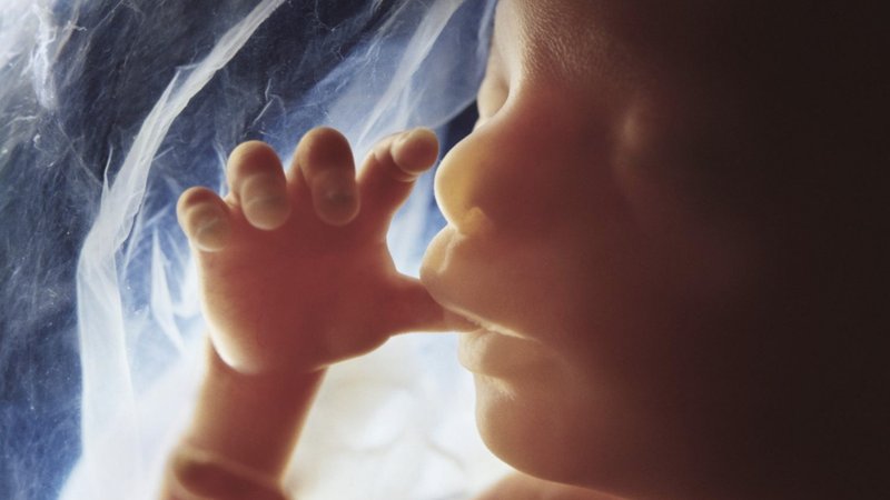 A 20-week-old unborn baby. (Image via speakingfortheunborn.com)