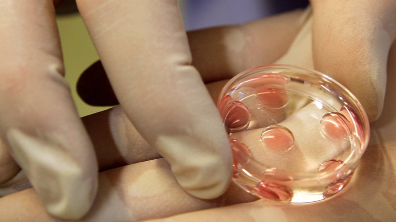 IVF