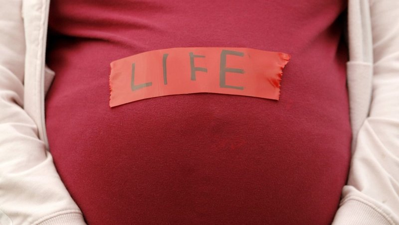 Pro-life