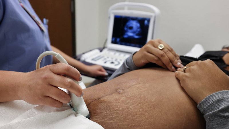 prenatal