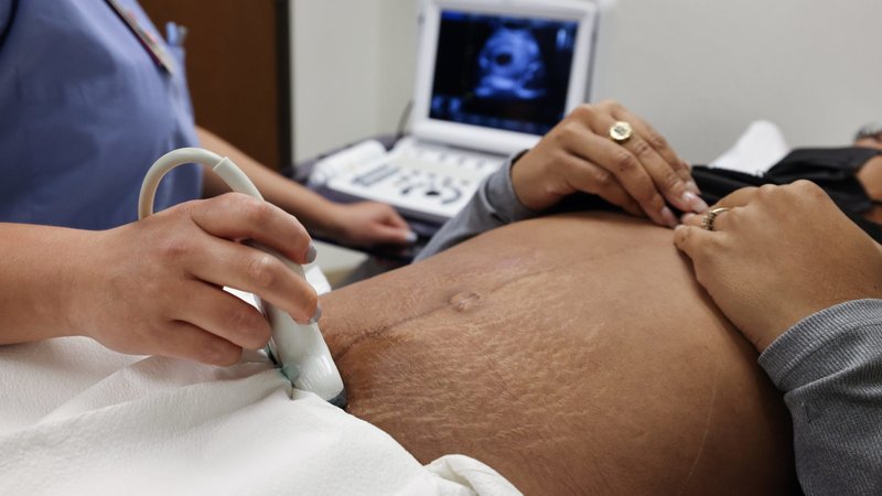 An ultrasound is conducted in this illustration photo. Abortion, which intentionally ends the life of an unborn child, is not health care, says a new publication by Dr. Ingrid Skop, an board-certified OB-GYN with more than 30 years of experience. She is the author of a 25-page paper titled "Is Induced Abortion Health Care?" and published Aug. 7, 2024, by the Charlotte Lozier Institute, the Arlington, Va.-based research education arm of the national pro-life group Susan B. Anthony Pro-Life America. (OSV News photo/Evelyn Hockstein, Reuters)