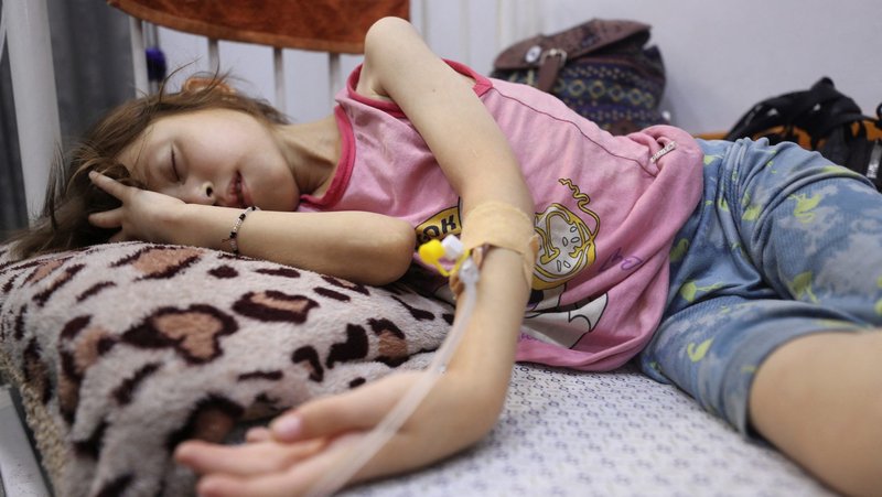 Young Palestinian ana Ayad, who is malnourished, according to medics, lies on a bed July 29, 2025, as she receives treatment at a hospital in Gaza City, Gaza Strip, amid a worsening hunger crisis. (OSV News photo/Mahmoud Issa, Reuters)